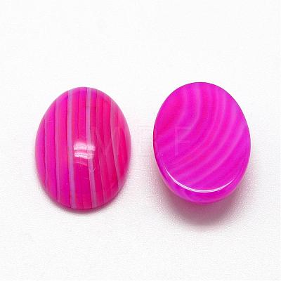 Natural Striped Agate/Banded Agate Cabochons G-R415-13x18-13-1
